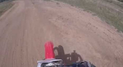 A Biker And His Injured Cheek! - Photo